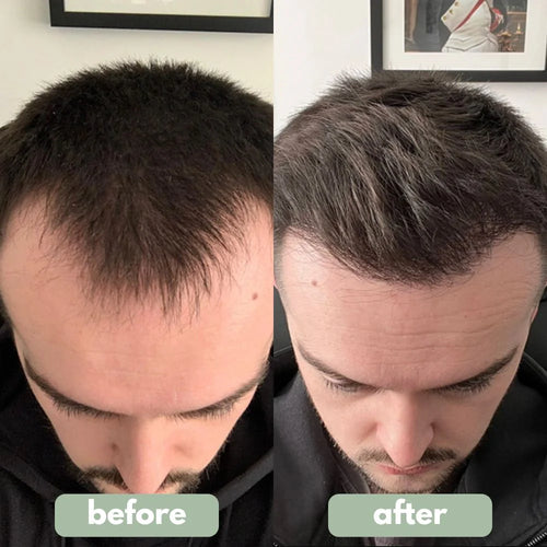 Hair Strengthening Oil with Heat Protection