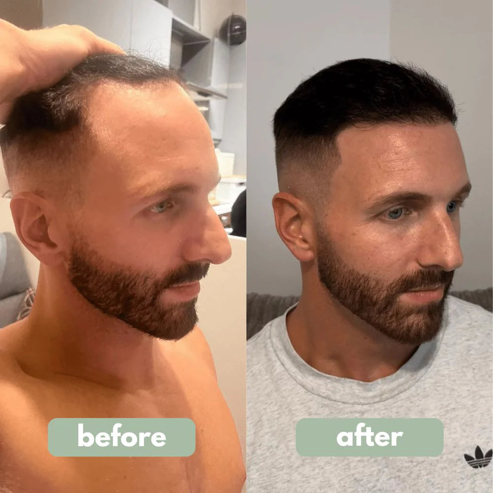 Hair Strengthening Oil with Heat Protection